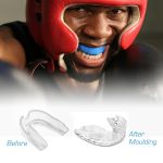 Mouth Guard