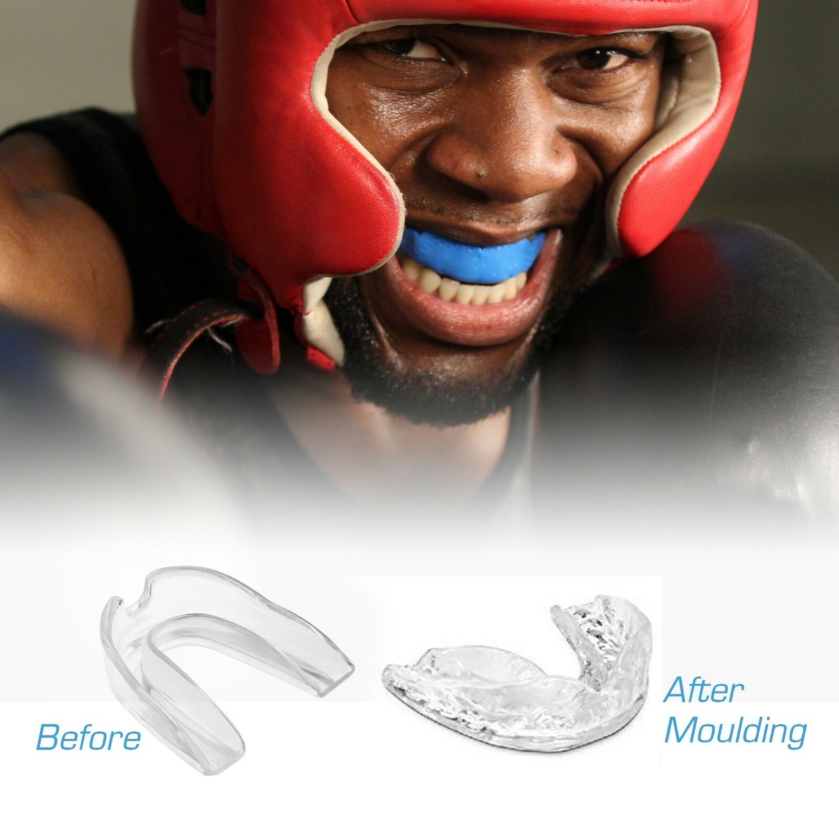 Mouth Guard-4 Mouth Guard - Image 1